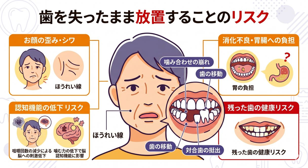 歯を失ったまま放置するリスク