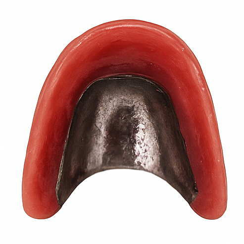 チタン床義歯