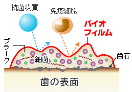 老化を防ぐ歯の清潔革命ってご存知でしょうか?