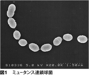 歯科治療の今昔、歴史を知れば現状がわかる