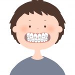 ワイヤー矯正中の食事で気をつけたいこと