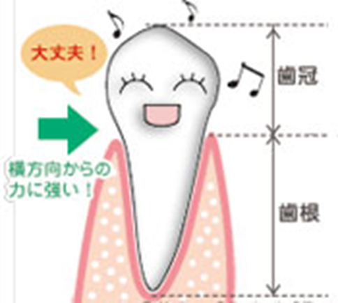 インプラント症例ブログ　その３