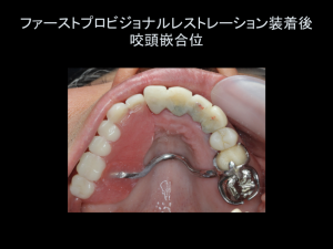 インプラント症例ブログ その4