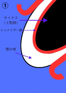 インプラント治療症例ブログ6 (前編)