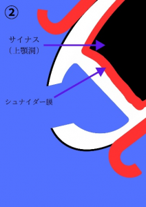 インプラント治療症例ブログ6 (前編)