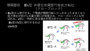 症例ブログ:顎関節症とその治療について