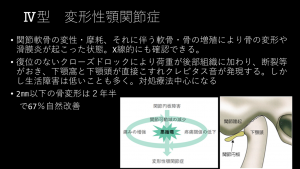症例ブログ:顎関節症とその治療について