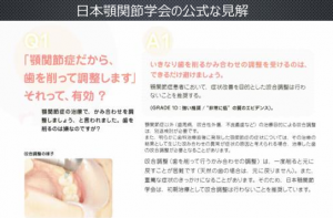 症例ブログ:顎関節症とその治療について その2