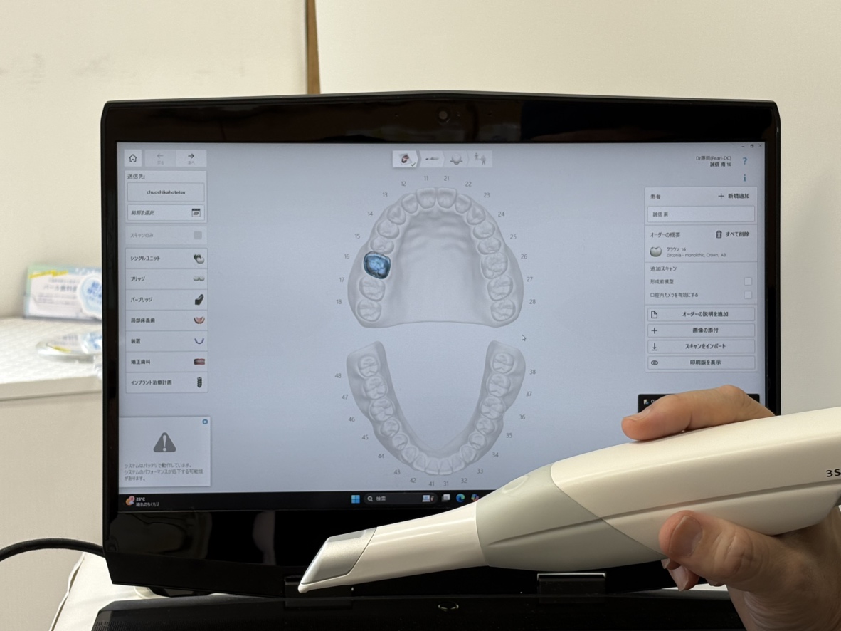 マイクロスコープ1